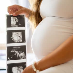 בדיקות הריון לפי טרימסטרים - אישה מחזיקה אולטרסאונד
